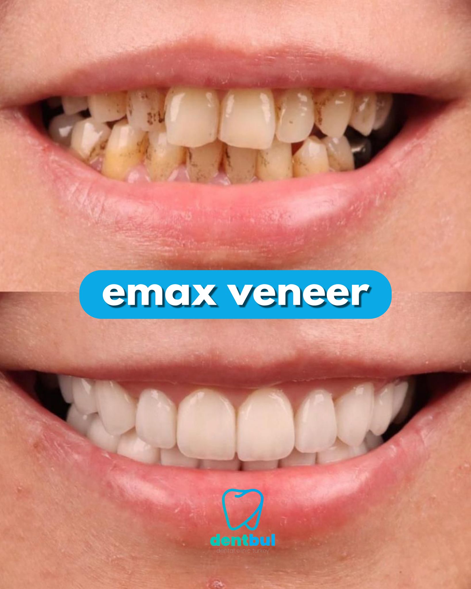 Dental Treatment Result