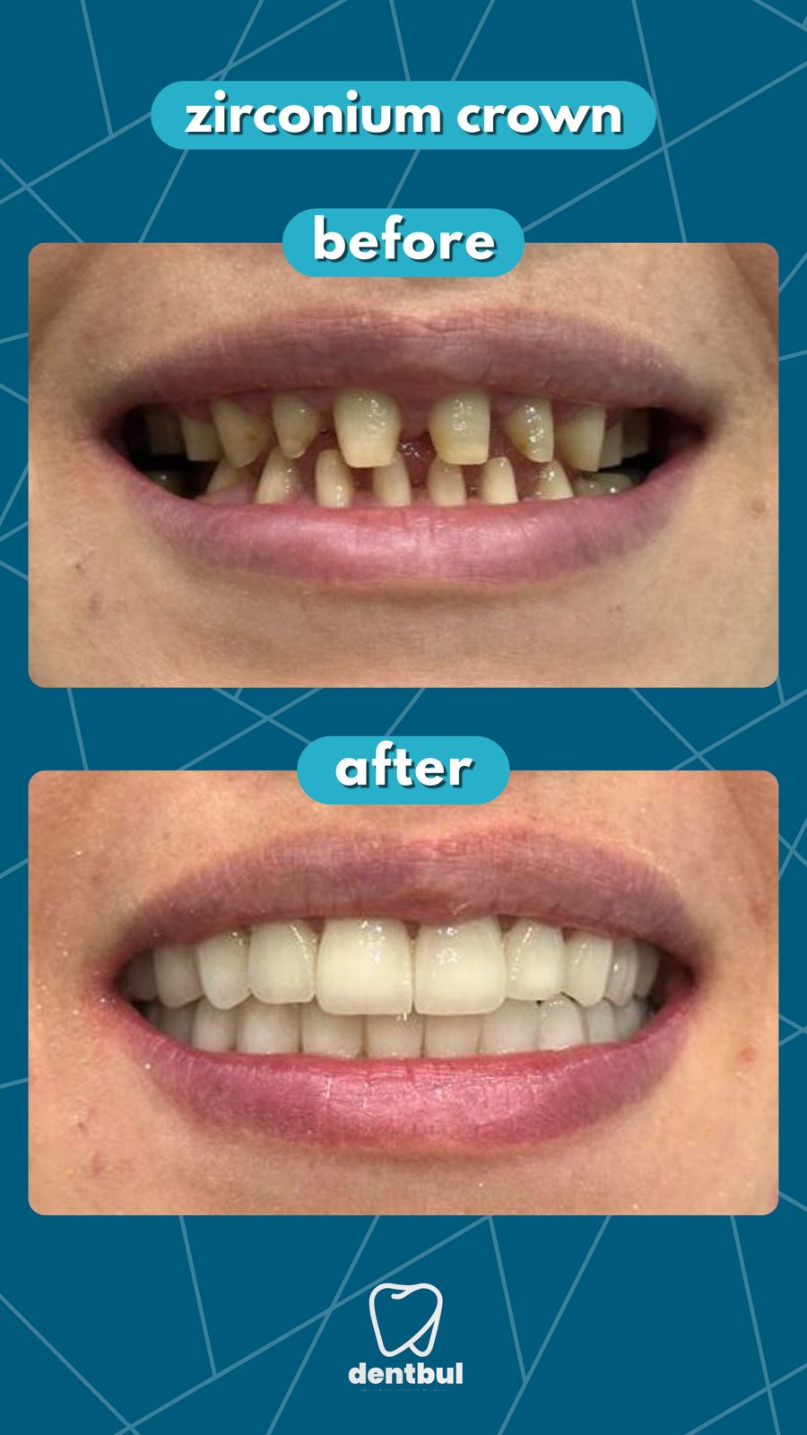 Dental Treatment Result