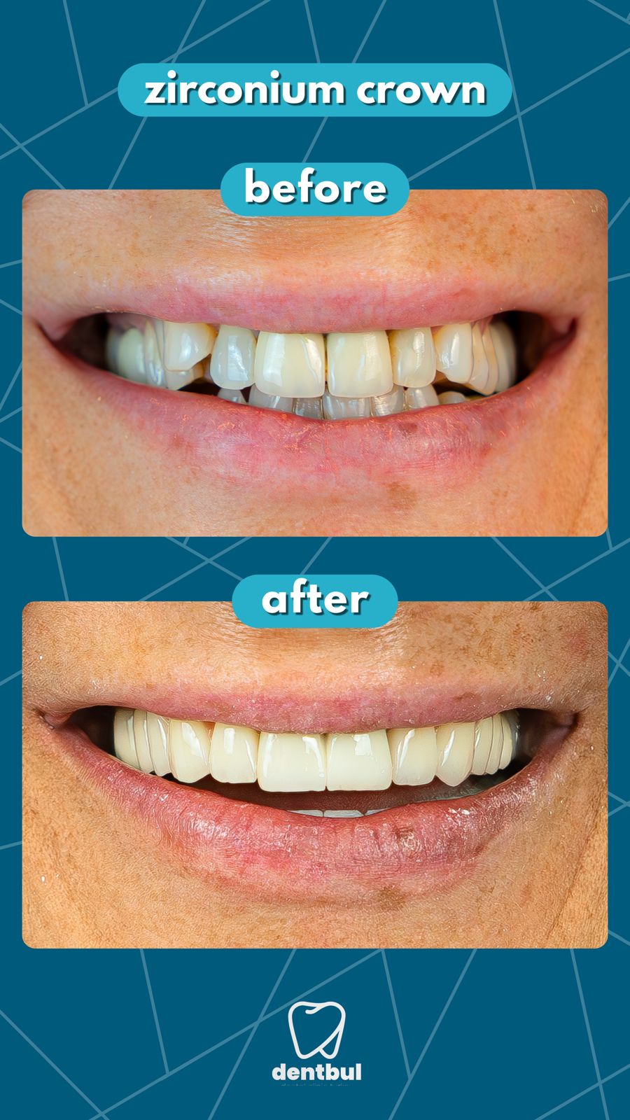 Dental Treatment Result