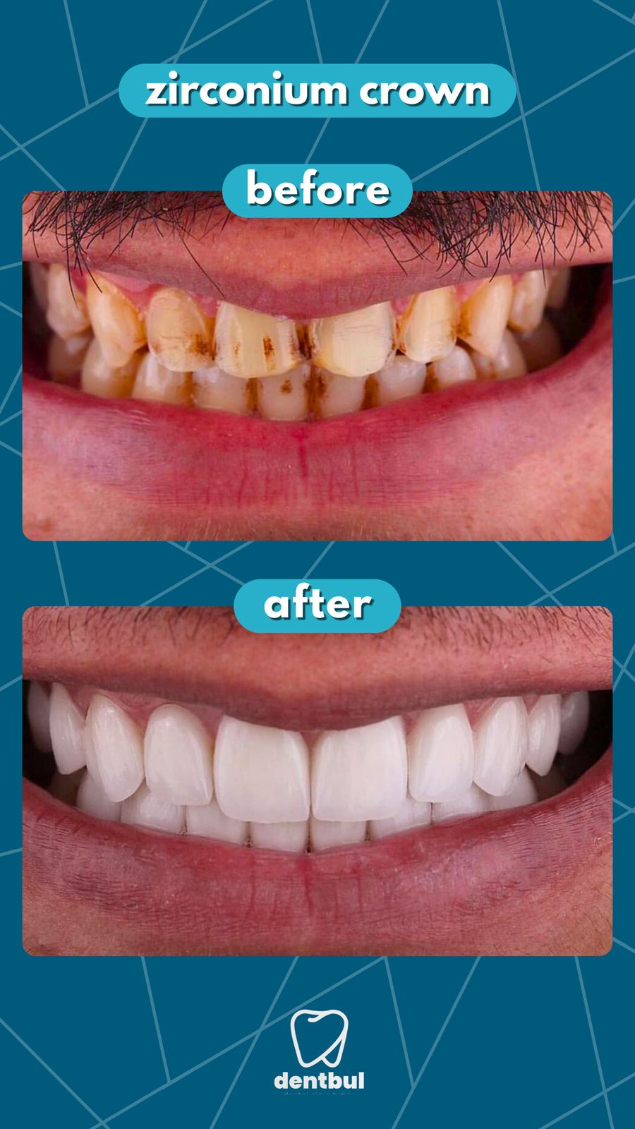 Dental Treatment Result