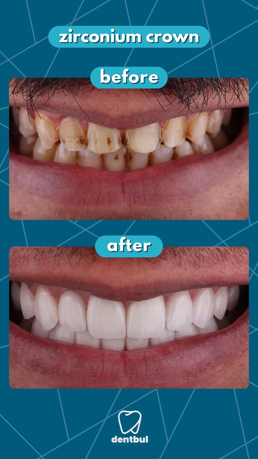 Dental Treatment Result